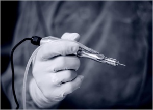 Rawatan tanam rambut memerlukan 2 minggu untuk pulih